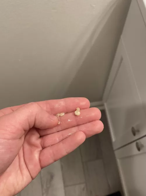 I was worried that I was getting sick because my tonsil was so swollen. Just found out the real reason. (Sorry only the photo, more came out later) by TheFanYeeter