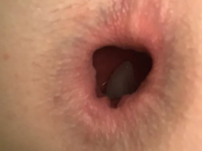 Ice cube in my gape was great! by Sins69420