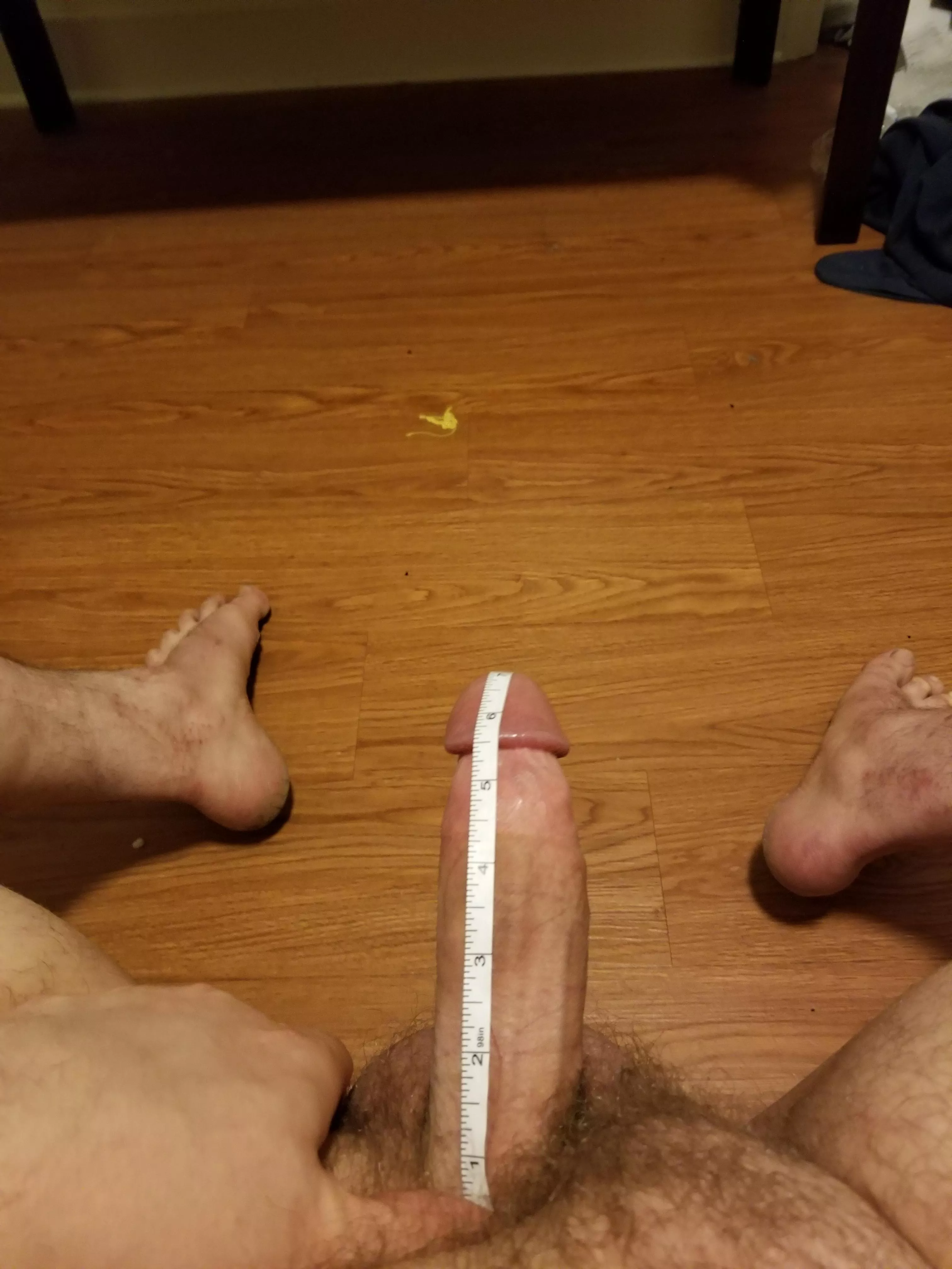 If anyone knows how to get rid of dick bruises I'd appreciate the advice lol posted by MisterUncrustable