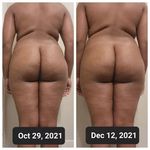 I'll soon have a roll all the way across my back! by vyanna1