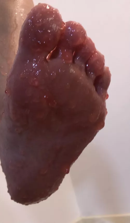 I’m covered in Jelly. Would you mind helping me clean up this mess? by HarleyHeel