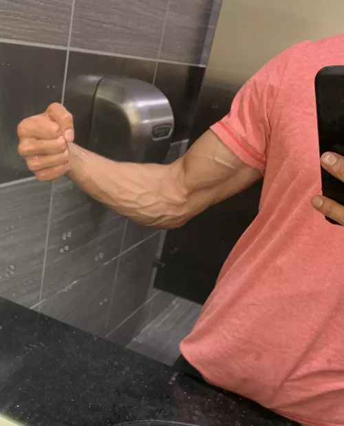 I’m so Vein! by Wingdingdong