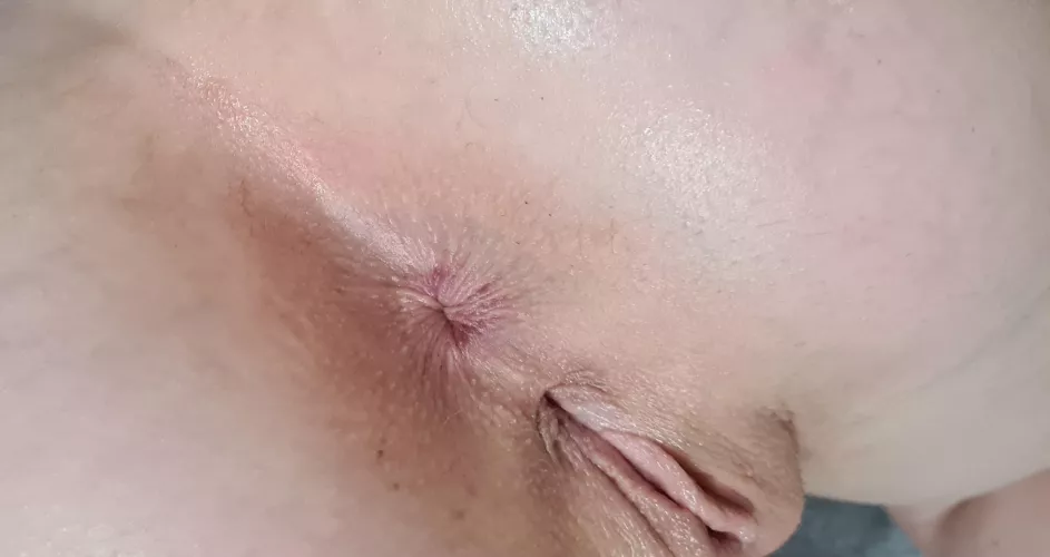 I'm starting to love my outie after hating it for years by kates_kitty