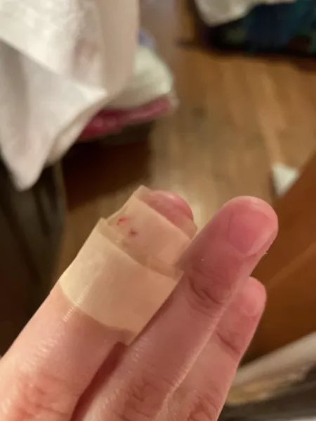 I’m too little to cut my own apples! But I tried 😭 now I’m wounded by Im_your_luna16