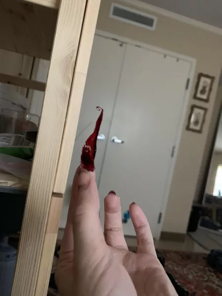 in a groggy, half-conscious state, felt something poking inside of my nose... proceeded to get a massive nosebleed after this.. pretty sure i just pulled a vital connection to my brain lmao by pheebs1313