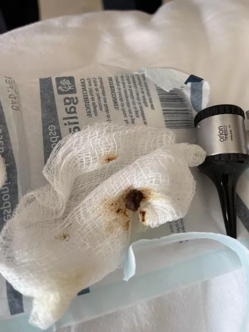 In a resort hospital with an ear infection. I wish y’all could’ve seen it. by roccofiko