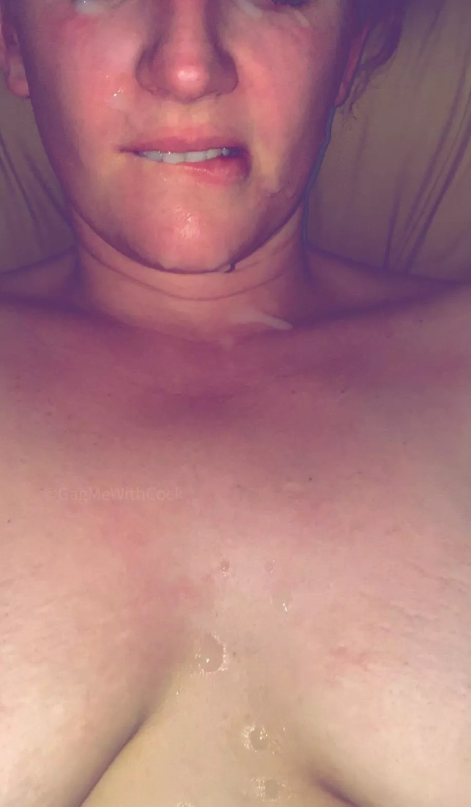 In both eyes.. posted by GagMeWithCock