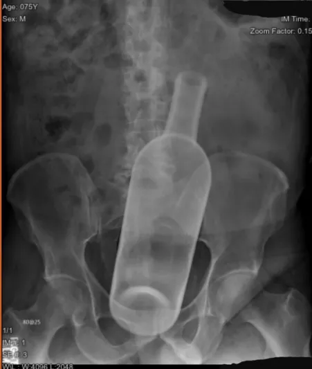 In response to the other post involving a wine bottle and Cindy rose by drifteddreams