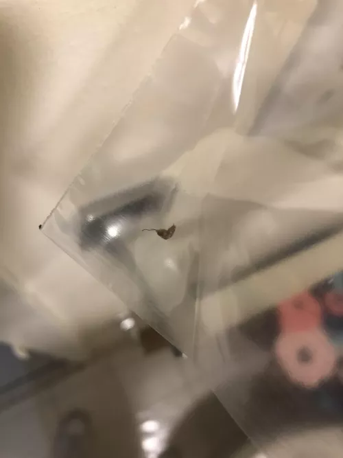 Ingrown hair or blackhead? by Josefk182