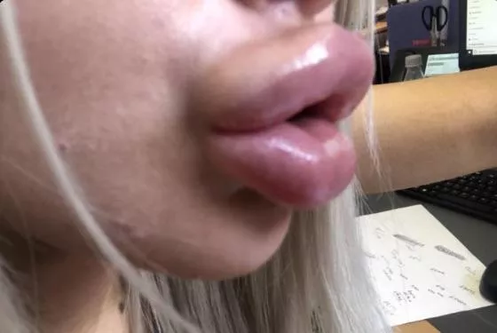 Insta profile pic I saw(username bimboprivate) posted by bimboalexis