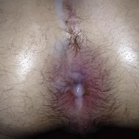 Is it bad that I spend the World AIDS Day with my legs open for all dick every year & even better if I know they are toxic by volfan1983xxx