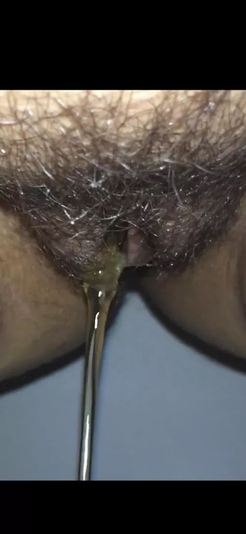 Is it too yellow? by Icy_Sound2596