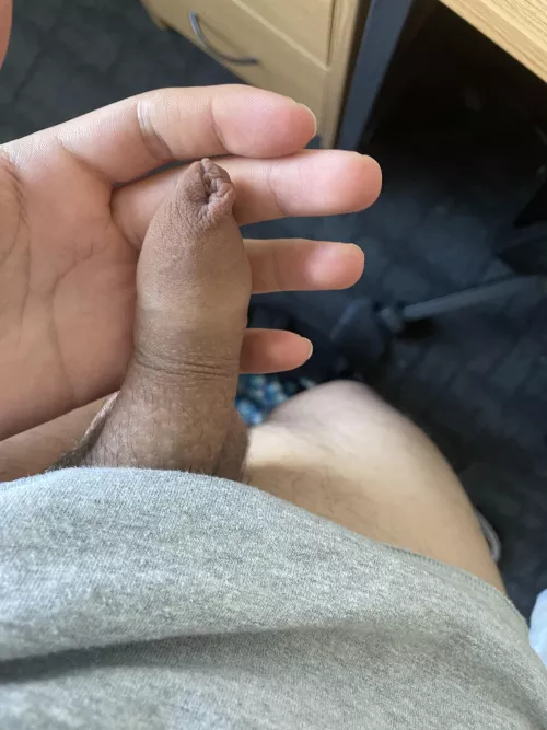 Is this normal by David_Almanza