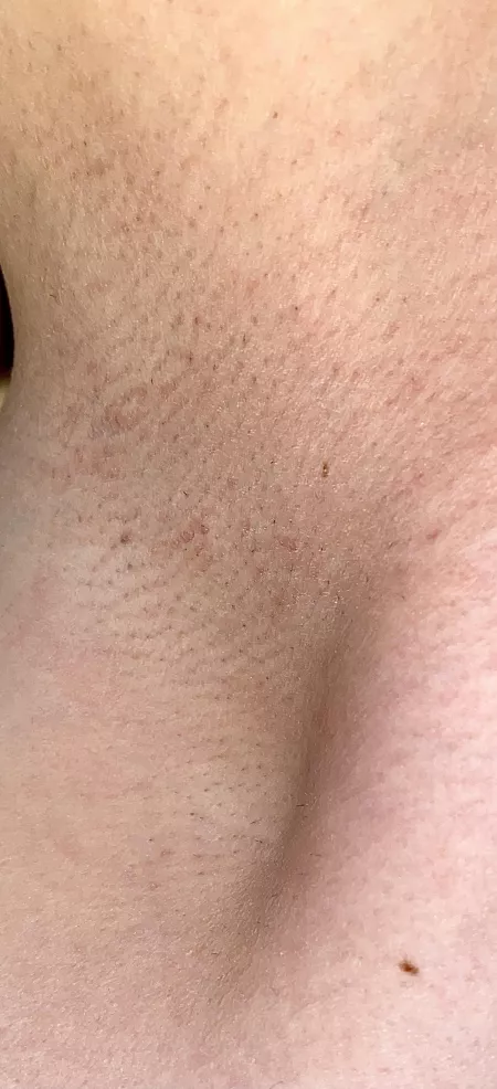 Is this smooth or stubbly 🤔😛 by sunnypits