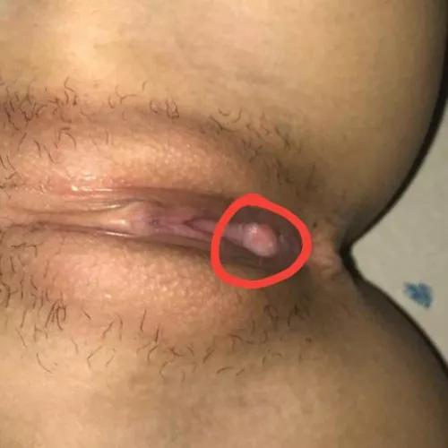 Is this something is should be concerned of? Please help by ikimokodomoe