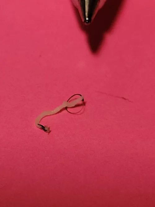 It just looked like a pin sized blackhead by imeanthisguy