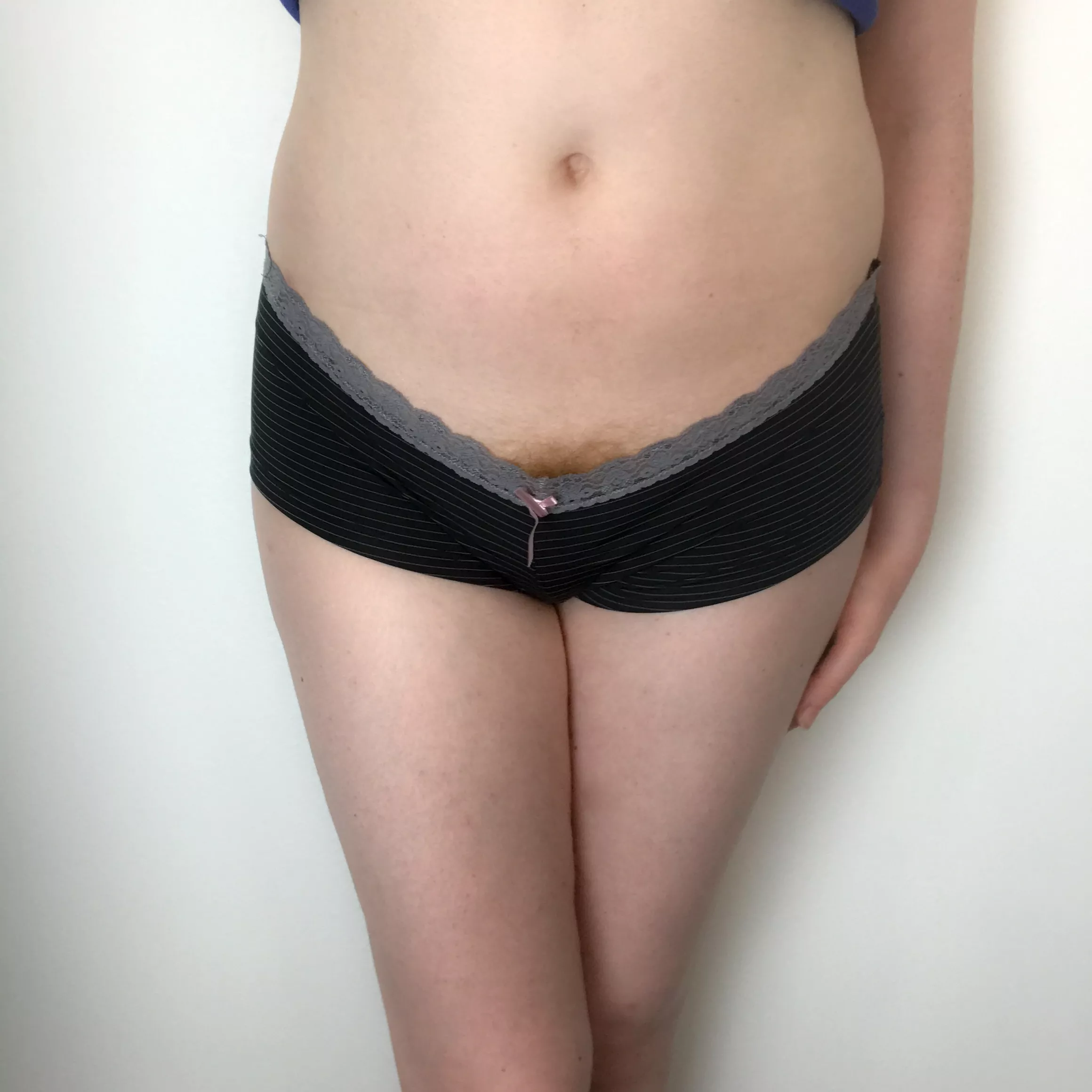 It's growing out of my panties now! posted by miacaysa00