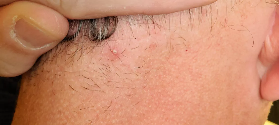 It's on the back of my neck, don't know how to capture by iwasafooltoo