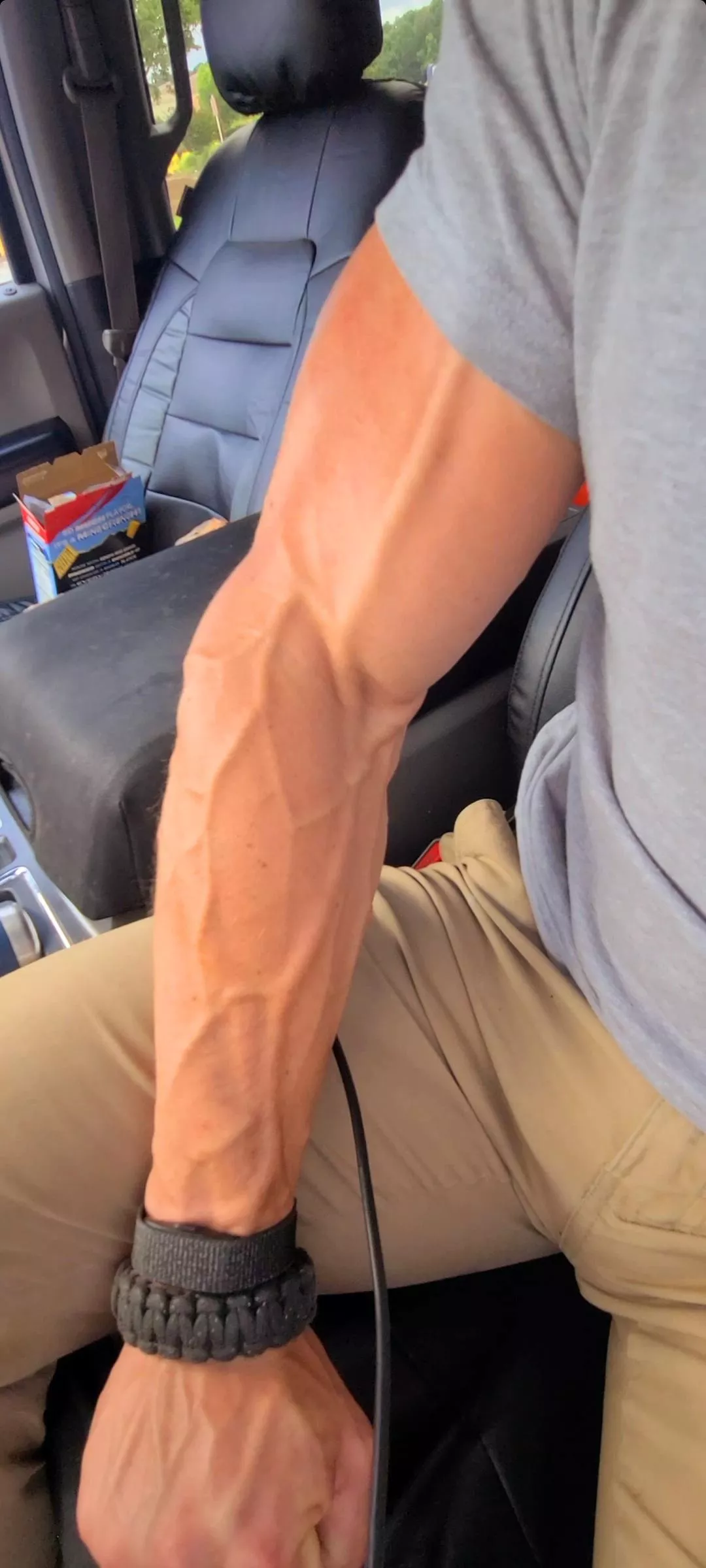 It's so squiggly... ish posted by prot_0