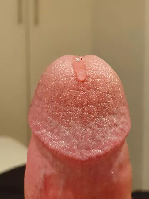 It's starting by anony1122b