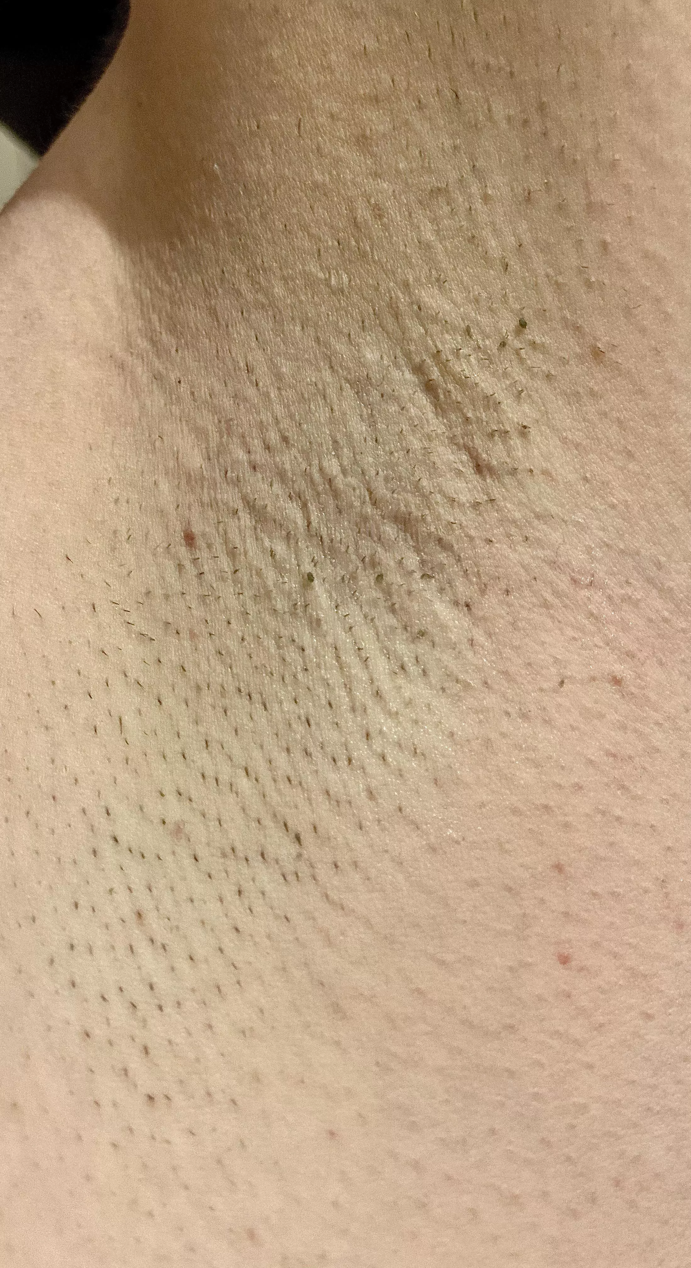 It’s the sweaty armpits time of the year posted by sunnypits