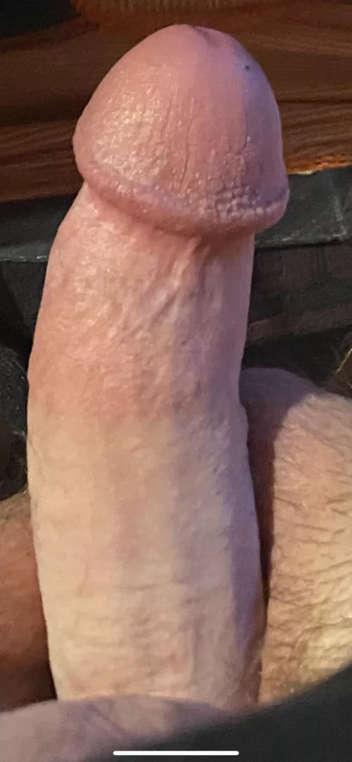 I’ve always been self conscious about it but woke up like this so I figured I’d post [38] by smdftb83