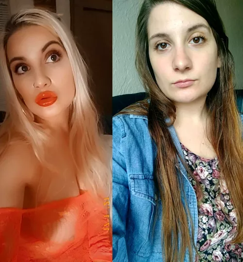 Just got my secnod syringe of filler in my lips and botox! Reflecting on my progress and tiny lips ‚ by hawseholeyelp