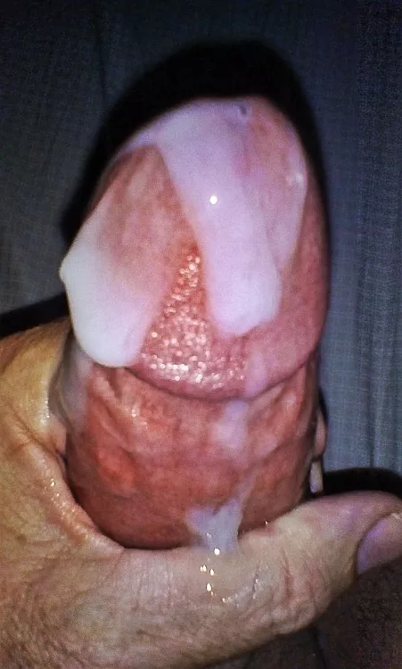 Just like a big strawberry with cream. Put your lips around and suck! by Not_George_Kaplan