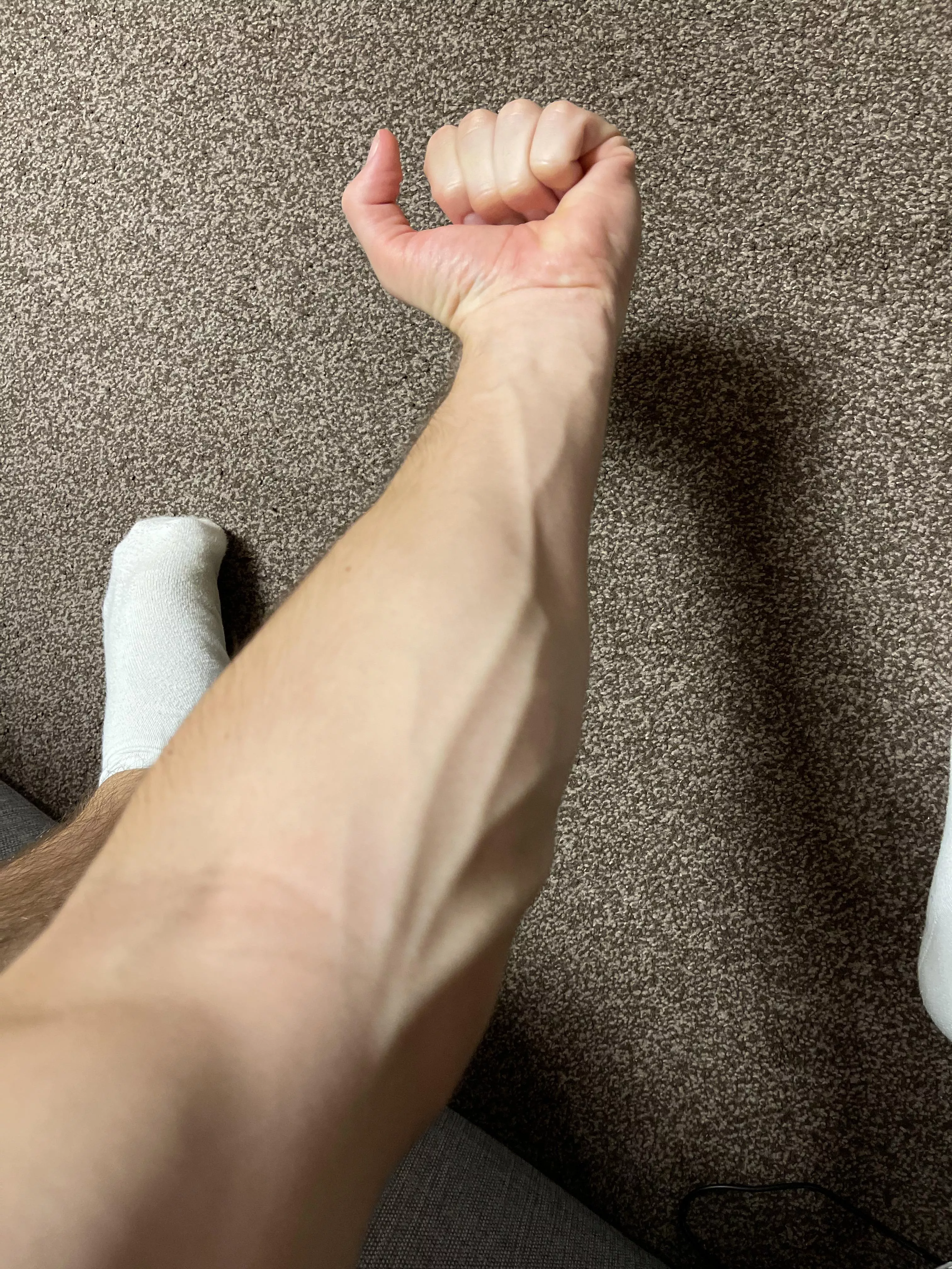 just my forearms posted by babyabs2