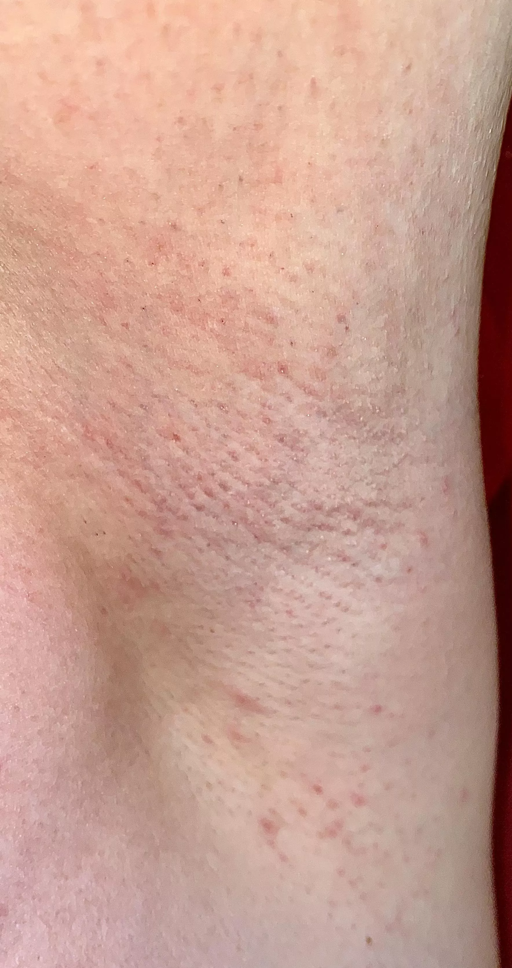 Just shaved for the second time today and I hope my armpits can survive that 🤣 posted by sunnypits