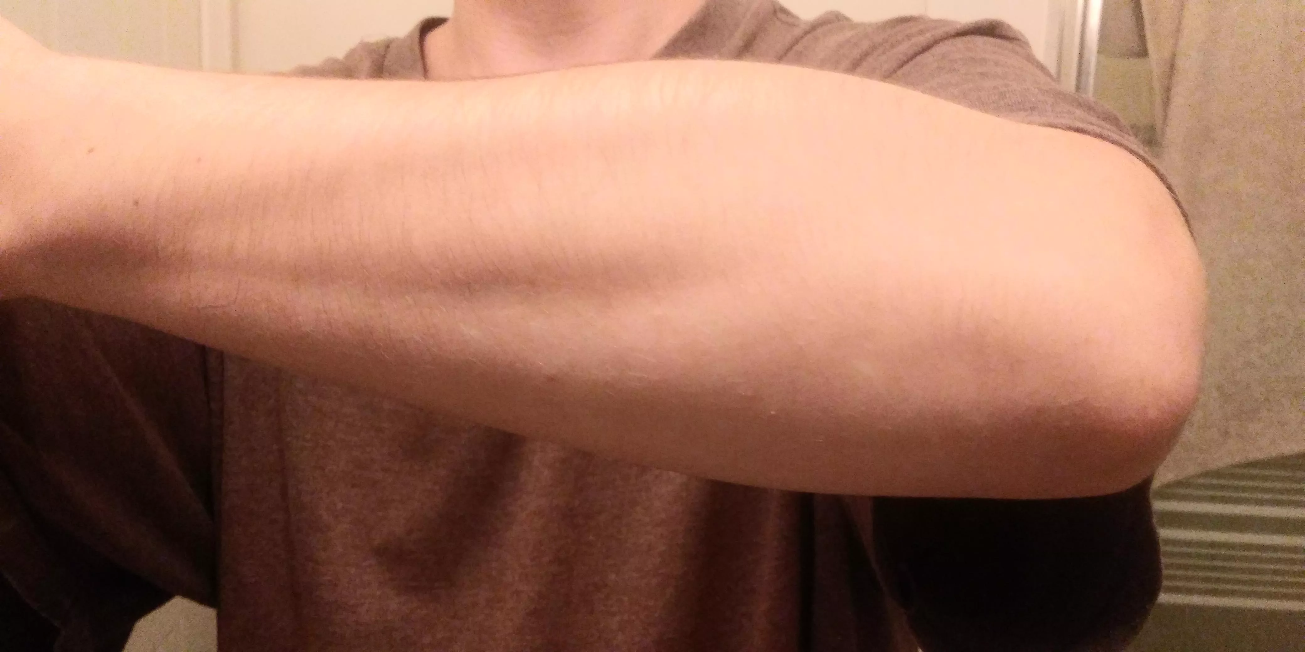 Just started lifting weights and I got this weird growth coming out top of my forearm. Do I stop now or keep going? posted by woofenruff