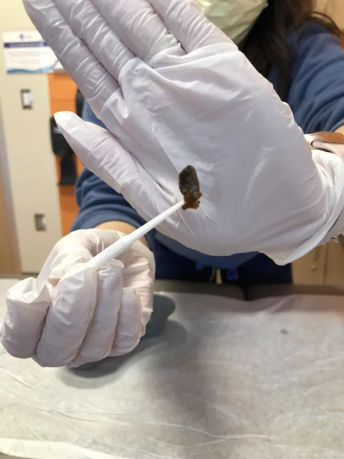 Kid had this pulled out today, sorry no video by jimistephen