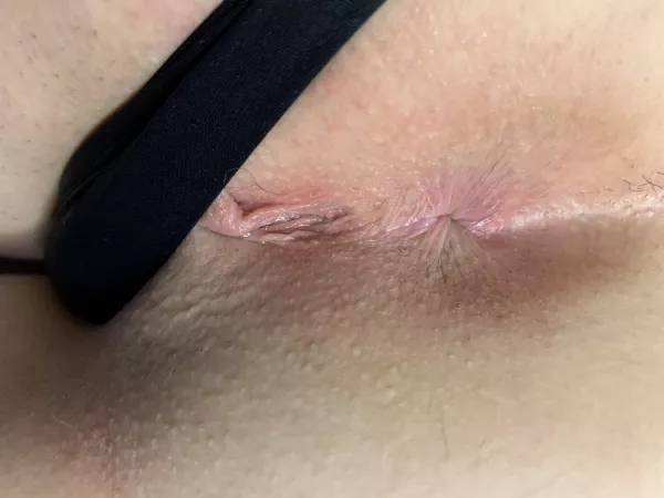 Kiss it 😘 by MinaAdora