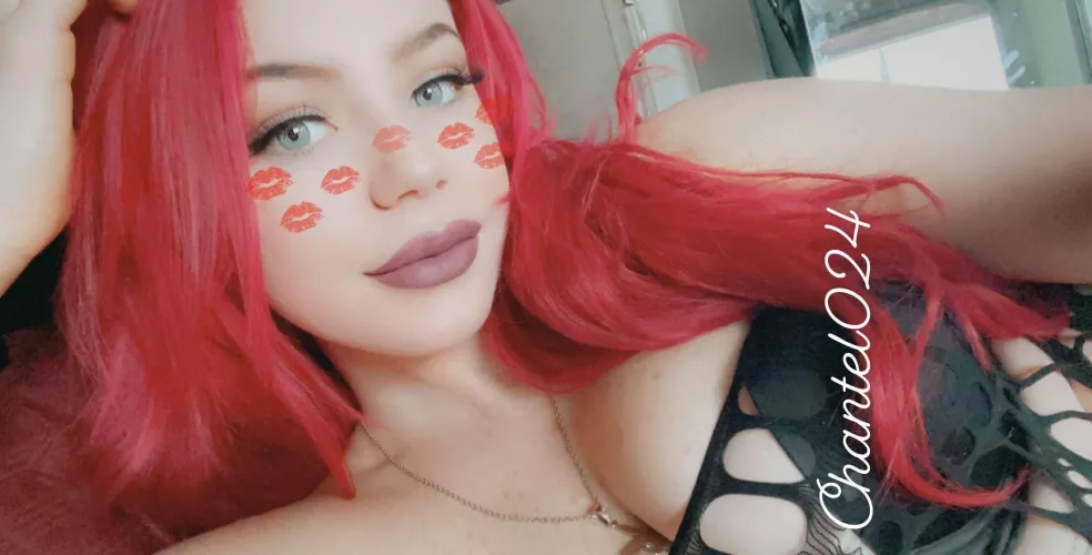 Kiss my freckles by chantel024