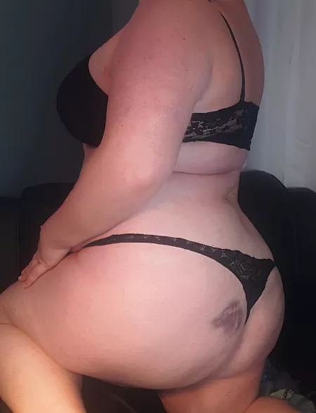 Krampus's love bite. by Softgothkitty