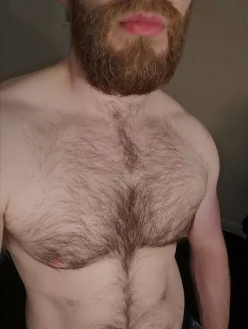 Lack of a tan update. by Content-Topic-1099