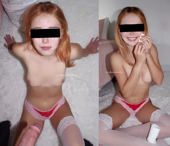 last friday my older brother's friend gave me a huge facial. here I am before and after cleanup!! (19 F) by CallMeKennedy