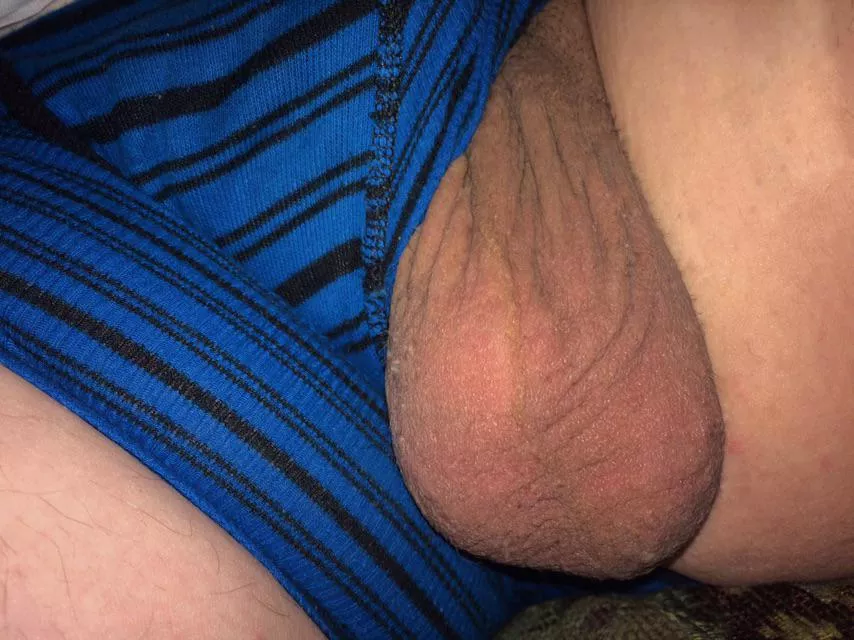 Let me put these in your mouth 😘 posted by Toxic_Fry