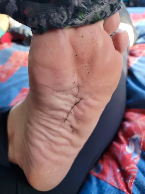 Lint trails by asrithmium