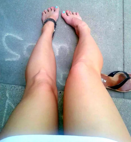 Little [F]eet and short legs by RedFox1988