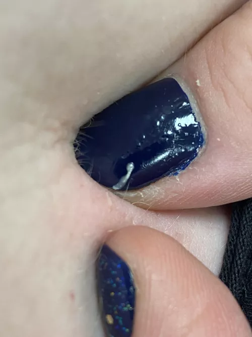 Little pop in the cleavage. Looked like nothing and then shot out like a mini fountain, wish I’d filmed! by onereallytiredgoose