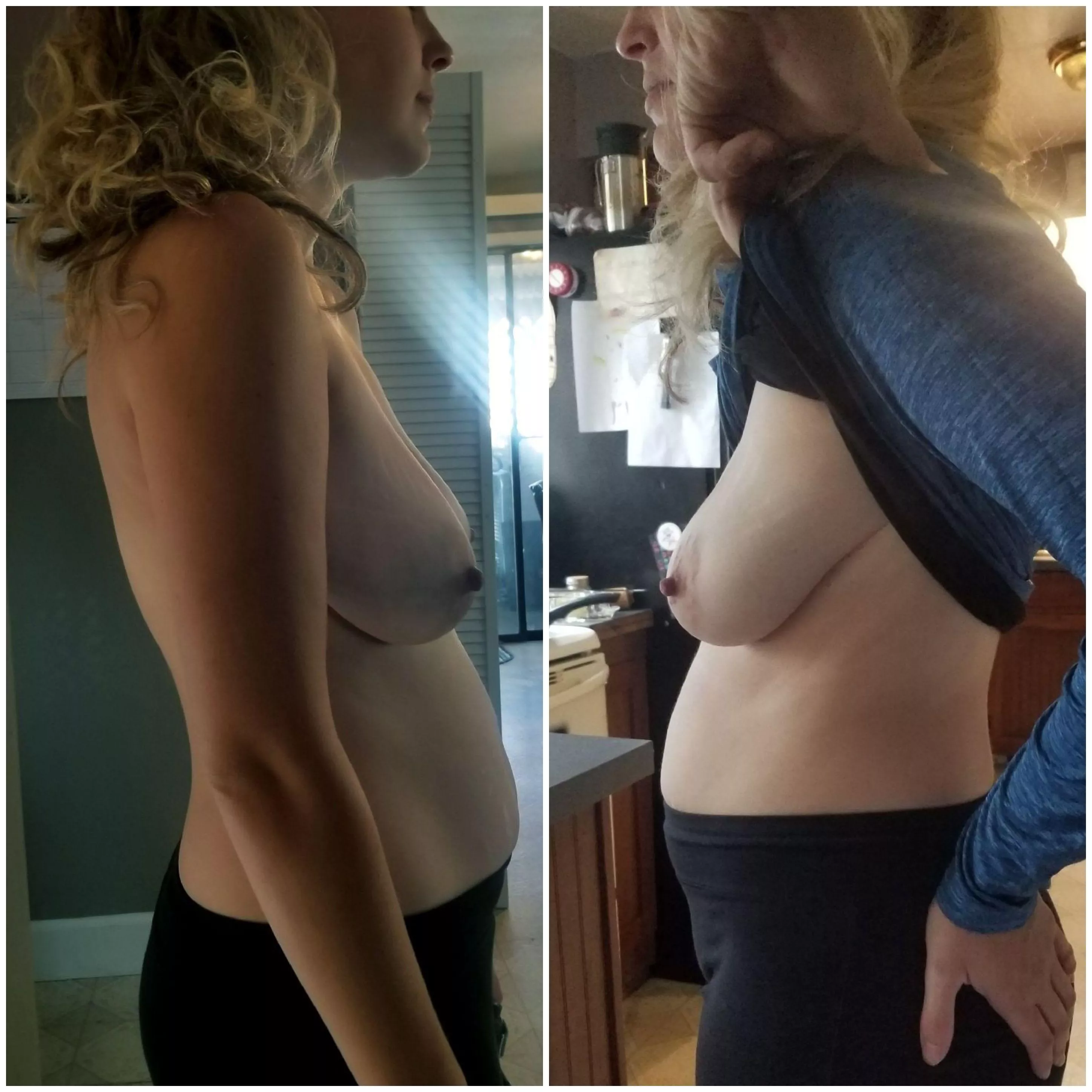 Looking better? posted by SnooCompliments7968