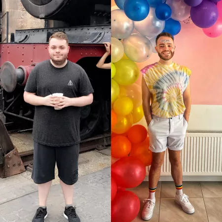 Lost a lot but gained my smile by pauldevlin_