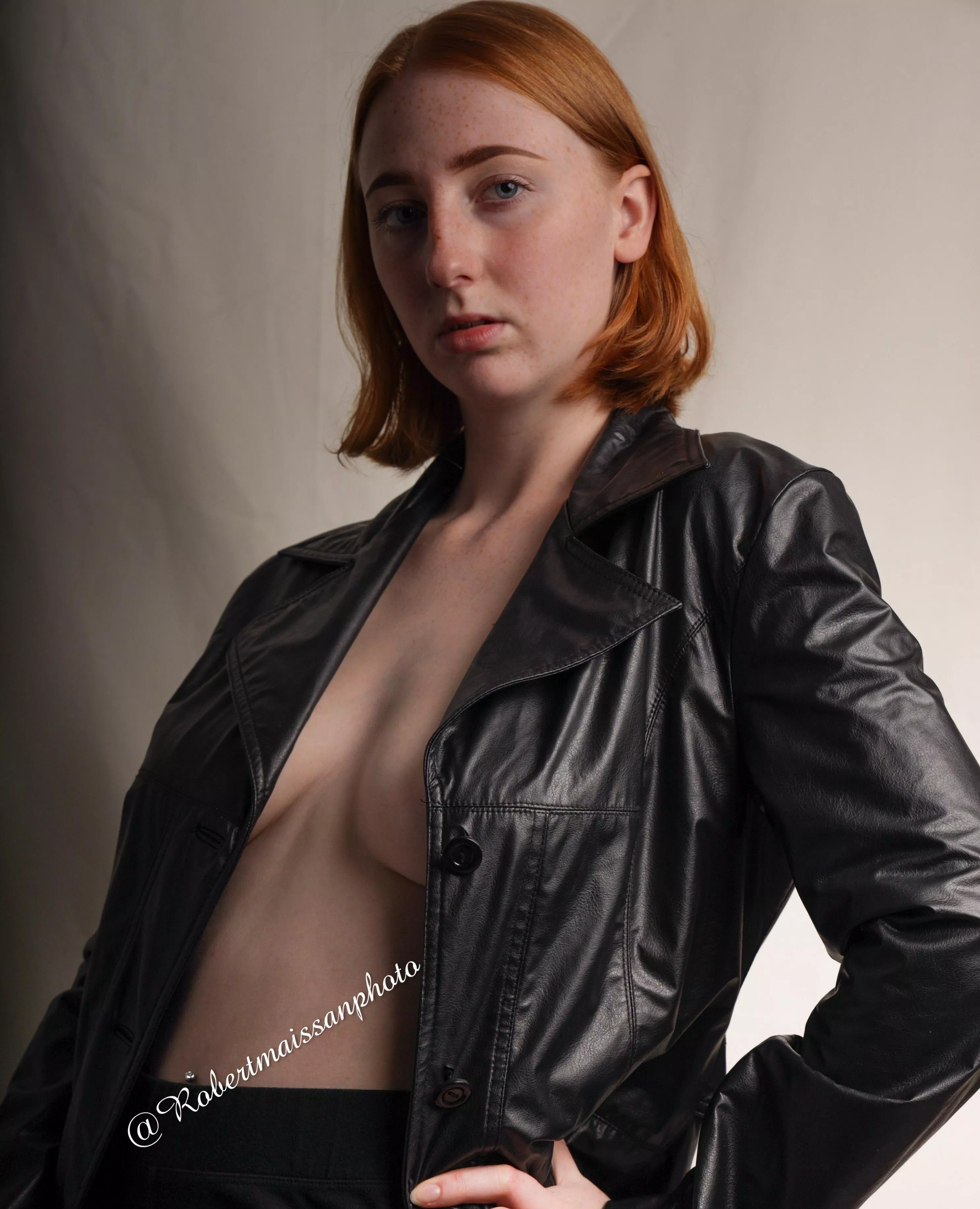 Love my freckles and red hair 👩‍🦰 posted by somethingaboutolives