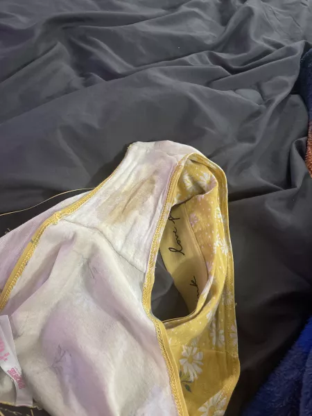 Marks like this means I hit the gym hard! DM me if interested! by ReyBaex