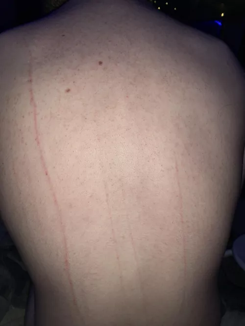 Master didn’t draw blood 😣 maybe they’ll grant me it next time by Zeacur