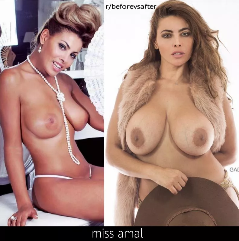 Miss Amal before and after pregnancy posted by culculdelalune