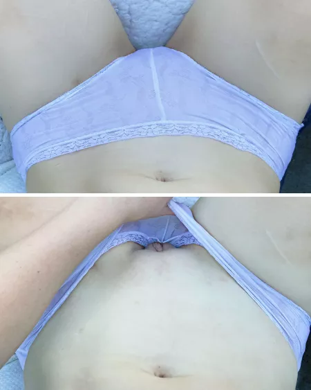 Missing those hot summer days playing with myself in my panties outside where my neighbours could catch me. by bluepixxxie