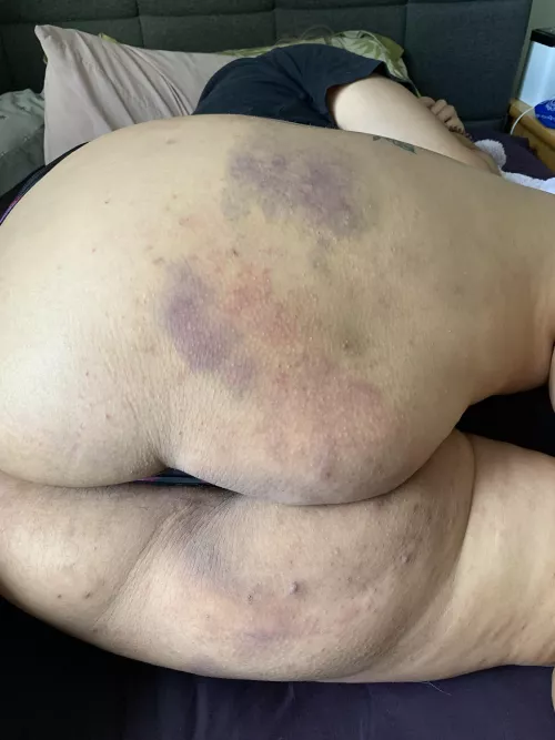 Mmm can’t wait to get bruised up this weekend by aqualovely