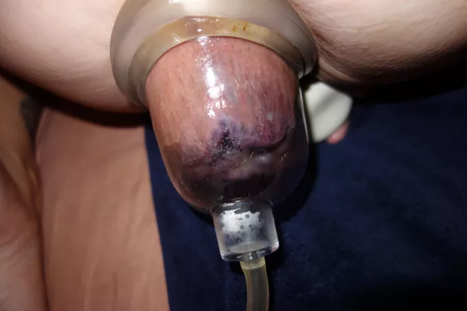 Mommy’s massive pumped purple asscunt by jonmja